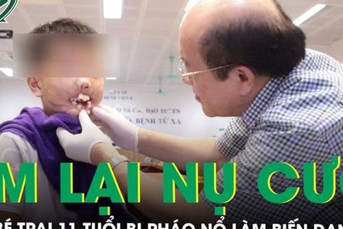 Vi phẫu tạo hình tìm lại nụ cười cho bé trai 11 tuổi bị pháo nổ làm biến dạng mặt
