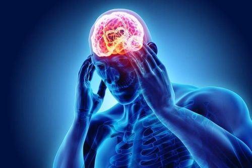 Đau nửa đầu tiềm ẩn nguy cơ đột quỵ não