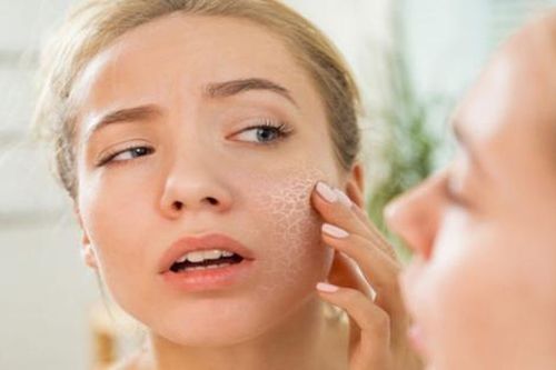 7 thành phần chăm sóc da khô hiệu quả nhất vào mùa đông