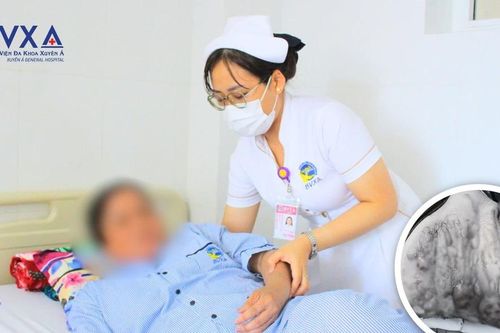 Người phụ nữ bỏng nặng khi đi giác hơi