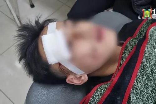 Thanh thiếu niên đánh đổi mạng sống chỉ vì thích thể hiện