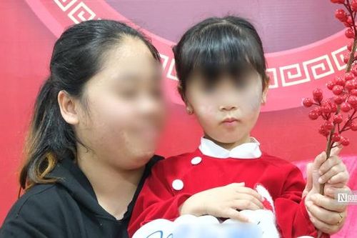Người mẹ trẻ bật khóc khi con gái 5 tuổi hỏi về khuôn mặt mình
