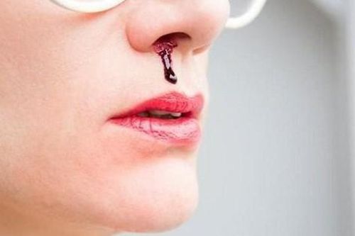 Câu hỏi thường gặp về bệnh giãn mao mạch xuất huyết di truyền