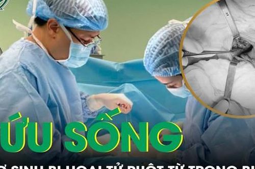 Hai bệnh viện phối hợp cứu bé sơ sinh vỡ ruột hoại tử từ trong bụng mẹ