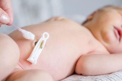 Những dấu hiệu bất thường về rốn của trẻ sơ sinh cha mẹ cần biết