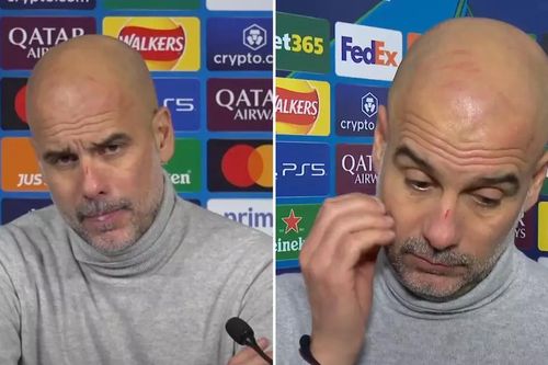 Dưới góc nhìn tâm lý học: Pep Guardiola tự cào mặt, làm đau chính mình và dấu hiệu của sự bất lực