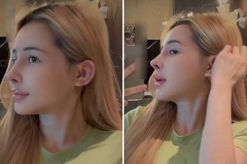 Ngân 98 khoe cận mũi mới sau 10 lần 'sửa sang'