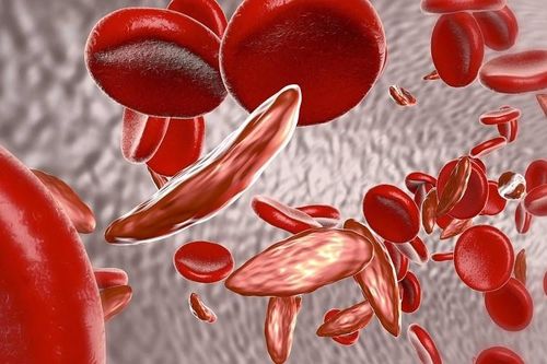 Cách phòng ngừa bệnh tan máu bẩm sinh