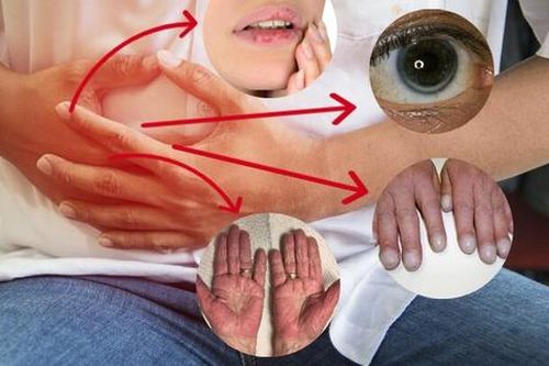 4 thay đổi trên cơ thể cảnh báo sớm chức năng gan suy yếu, cơ thể tích đầy độc tố