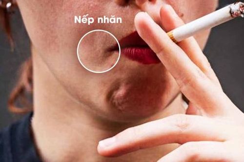 Hút thuốc lá làm tăng quá trình lão hóa, sớm xuất hiện các nếp nhăn