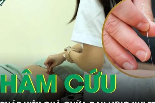 Châm cứu: giải pháp hiệu quả chữa đau lưng khi trời lạnh