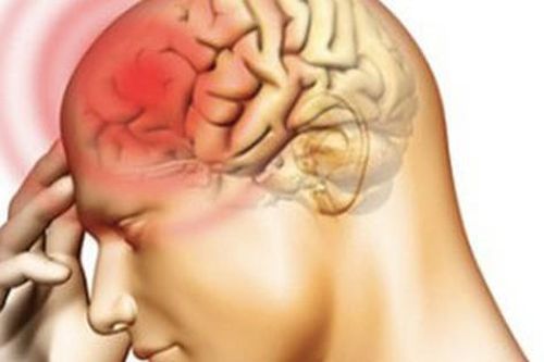 Viêm não có nguy cơ tử vong cao nếu kèm theo những điều này