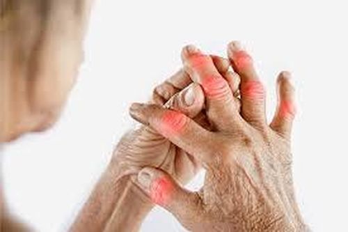 Cách phòng ngừa viêm khớp dạng thấp khi trở lạnh