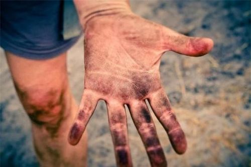 Tại sao bàn tay con người có 5 ngón mà không phải 4 hay 6 ngón?