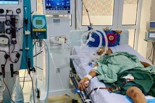 Thanh niên đang khỏe mạnh bất ngờ suy đa phủ tạng sau giết mổ lợn