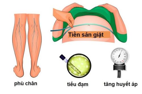 Nhận biết và phát hiện sớm nguy cơ tiền sản giật thai kỳ