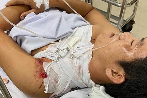 Dùng đao tự chế chém hàng xóm