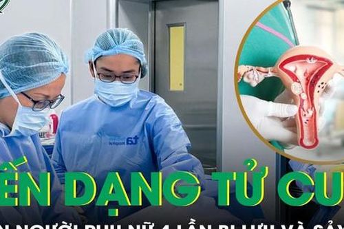 Biến dạng tử cung khiến người phụ nữ sảy thai 4 lần