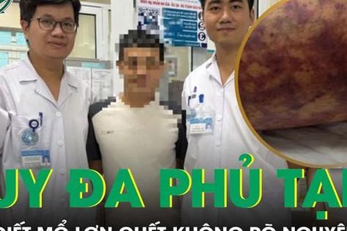 Suy đa phủ tạng do giết mổ lợn chết không rõ nguyên nhân