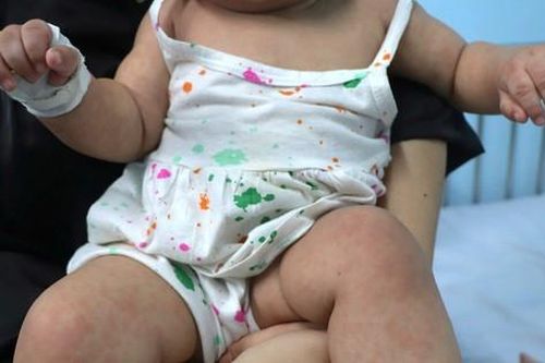 Tin tức Đời sống 5/12: Cha mẹ 'anti vắc xin', con bị đẩy vào vòng nguy hiểm