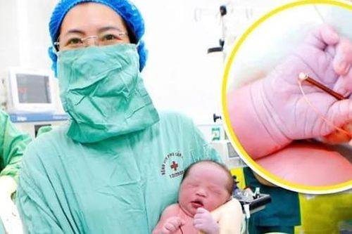 Hy hữu bé trai chào đời cùng vòng tránh thai của mẹ