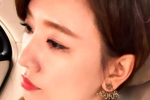 Tình trạng của Hari Won sau khi ngã cầu thang cuốn: 'Vẫn đang tệ lắm'