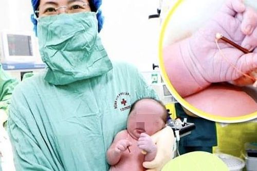 Tin tối 6/12: Bé trai chào đời cùng vòng tránh thai của mẹ; khối không khí lạnh tăng cường, miền Bắc mưa rét bao lâu?