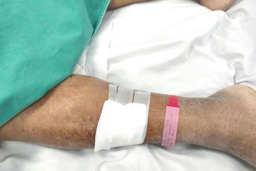 Tai nạn nhỏ trên đường khiến người đàn ông nguy kịch