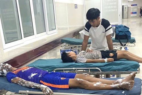Quảng Bình: Bốn học sinh bị bỏng nặng do làm pháo theo hướng dẫn trên Youtube