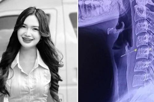 Cảnh báo từ vụ việc nữ ca sĩ Thái Lan qua đời sau khi đi mát-xa cho đỡ đau lưng