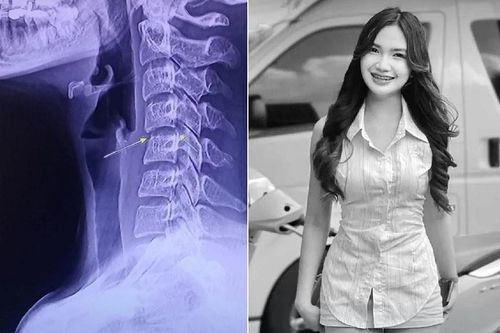 Vụ nữ ca sĩ tử vong vì massage cổ vai gáy gây sốc ở Thái Lan