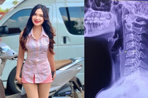 Cảnh báo từ cái chết thương tâm của nữ ca sĩ Thái Lan sau khi massage cổ vai gáy