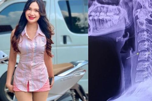 Mối nguy từ liệu pháp massage 'vặn cổ' sau cái chết của ca sĩ trẻ Thái Lan