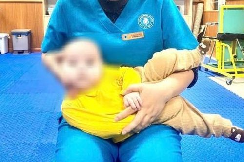 Bé 4 tháng tuổi vẹo cổ do gia đình làm việc này quá sớm