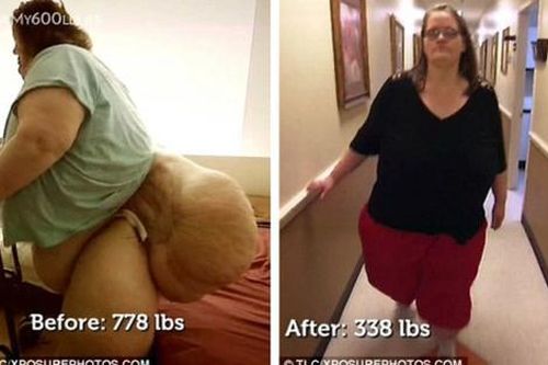 Người phụ nữ béo nhất thế giới, từng nặng 353kg giờ ra sao?