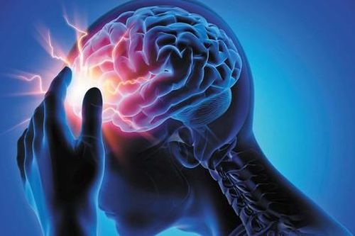 Cô gái 25 tuổi mù mắt trái sau cơn đau đầu bất thường