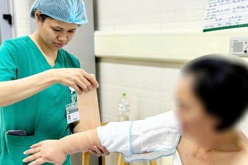 Thu nhỏ cánh tay cho bệnh nhân phù bạch mạch, bác sĩ chỉ ra các dấu hiệu dễ nhận biết bệnh