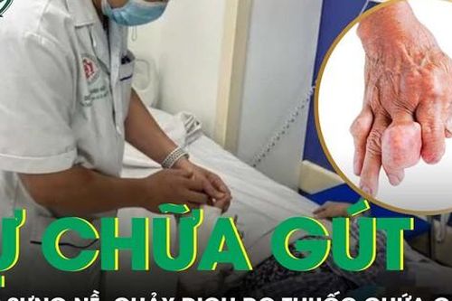 Tay chân sưng nề, chảy dịch do tự mua thuốc điều trị gút