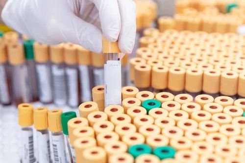 Hơn 300 lọ virus thất lạc ở Australia nguy hiểm thế nào?