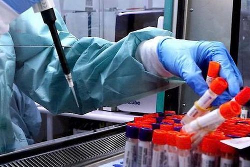Australia làm thất lạc 300 lọ virus nguy hiểm chết người