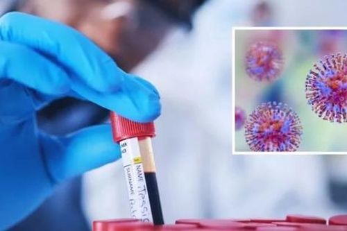 Úc thừa nhận mất 323 mẫu virus nguy hiểm chết người như COVID-19 từ 2021