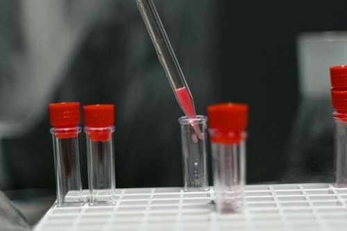 Nóng: Australia làm thất lạc 300 lọ virus, tất cả đều cực kỳ nguy hiểm với con người