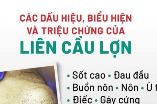 Sốt cao đi khám, người đàn ông được chẩn đoán mắc liên cầu lợn