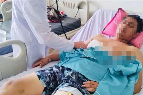 Bà Rịa – Vũng Tàu: Cứu sống bệnh nhân bị đâm thủng phổi