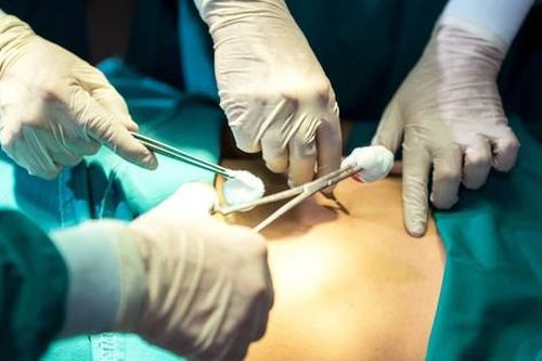 Thực hiện liên tục 6 ca phẫu thuật thẩm mỹ trong 24 giờ, người phụ nữ tử vong