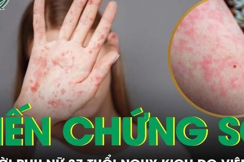 Người phụ nữ nguy kịch vì căn bệnh tưởng chỉ mắc ở trẻ nhỏ
