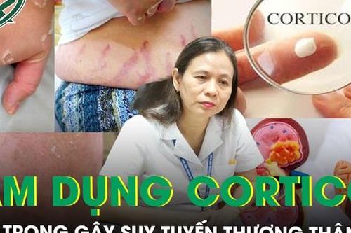 Cẩn trọng lạm dụng corticoid gây suy tuyến thượng thận
