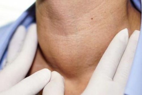 Có 10 dấu hiệu này bạn cần nghĩ ngay tới bệnh lý tuyến giáp