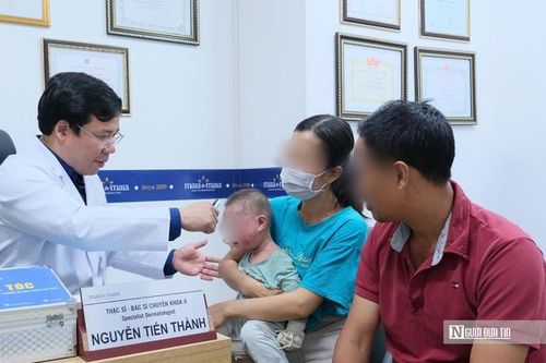 Bé 1 tuổi phồng rộp cả mặt chỉ vì hành động thường ngày, bác sĩ nói gì?