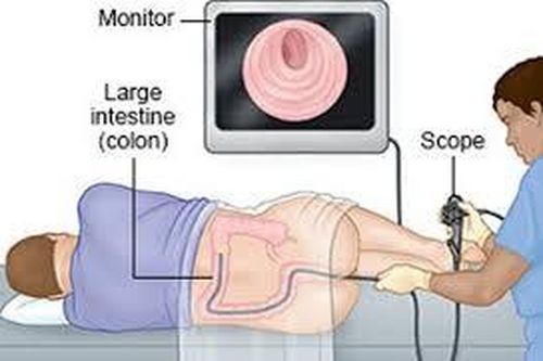 Nội soi đại tràng có gây ảnh hưởng sức khỏe?
